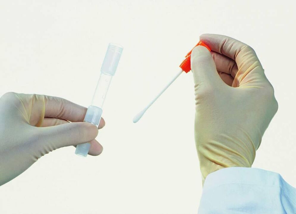 Sammlung von Tests zur Erkennung chronischer Prostatitis