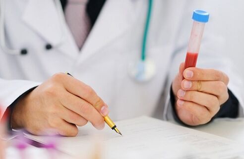 Prostatitis-Test für verschreibungspflichtige Medikamente